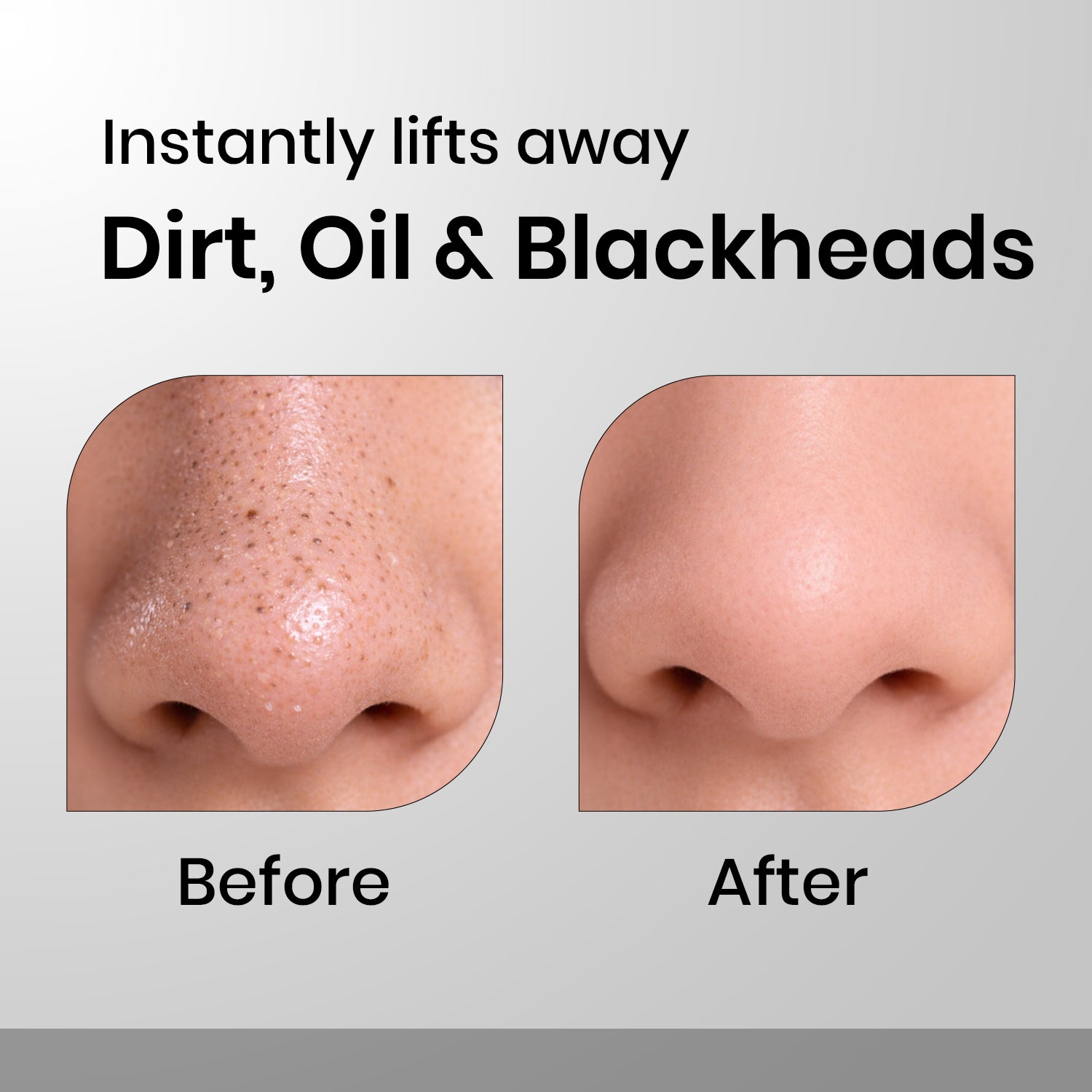 Cleansing Nose Strips